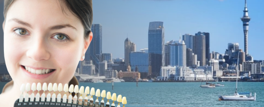 Best Teeth Whitening in Auckland