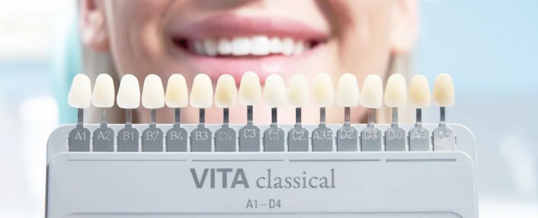 How White Can Teeth Actually Get?