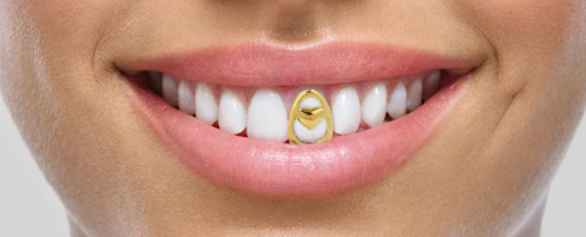 Teeth whitening craze makes for better smiles but fewer gold sales