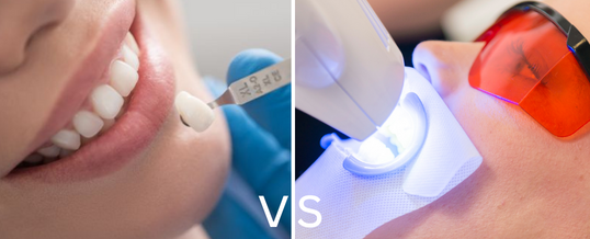 Teeth Whitening vs Dental Veneers
